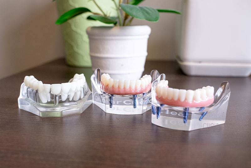 many options one choice at dr brendas office